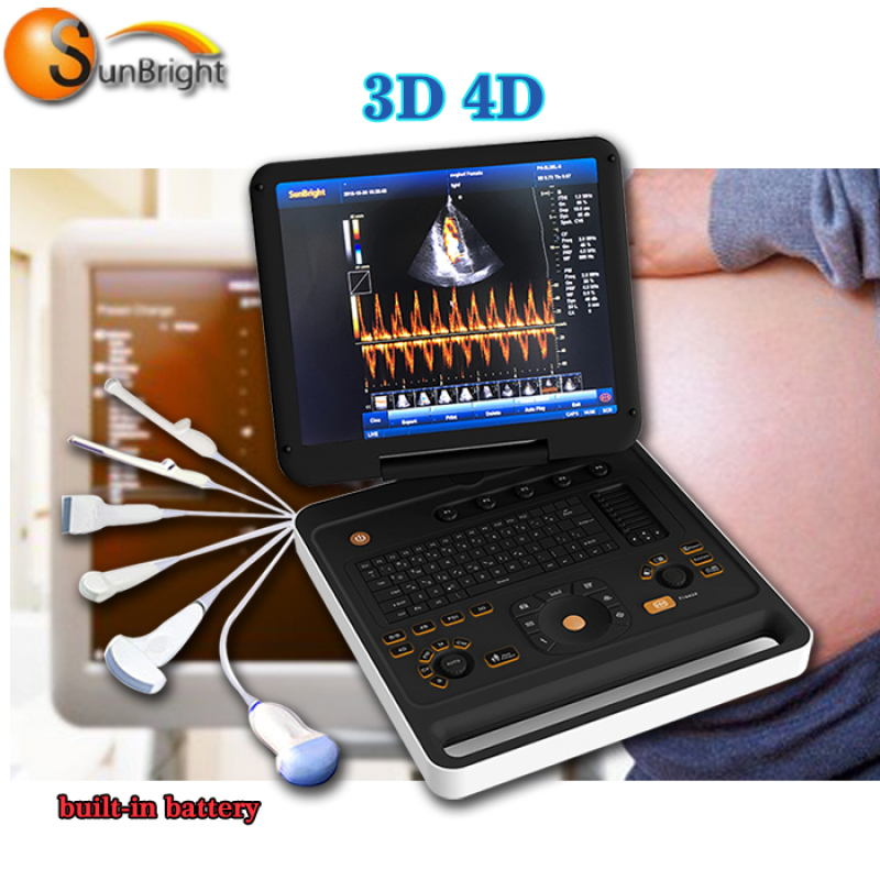 인간과 동물을 위한 높은 정의 4D 색깔 도풀러 초음파 스캐너 진단 초음파 장치