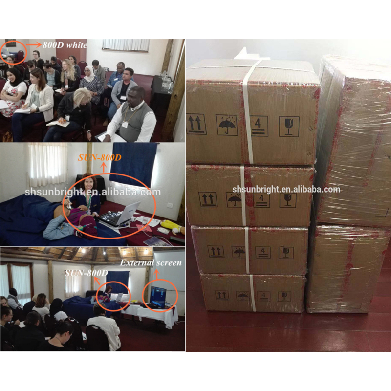 Portable best selling digital 3d ultrasound equipment for human with CE