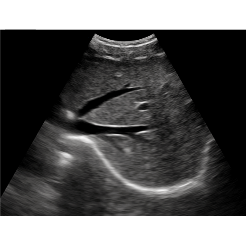 portable advanced hospital direct manufacturer usb mobile phone ultrasound probe