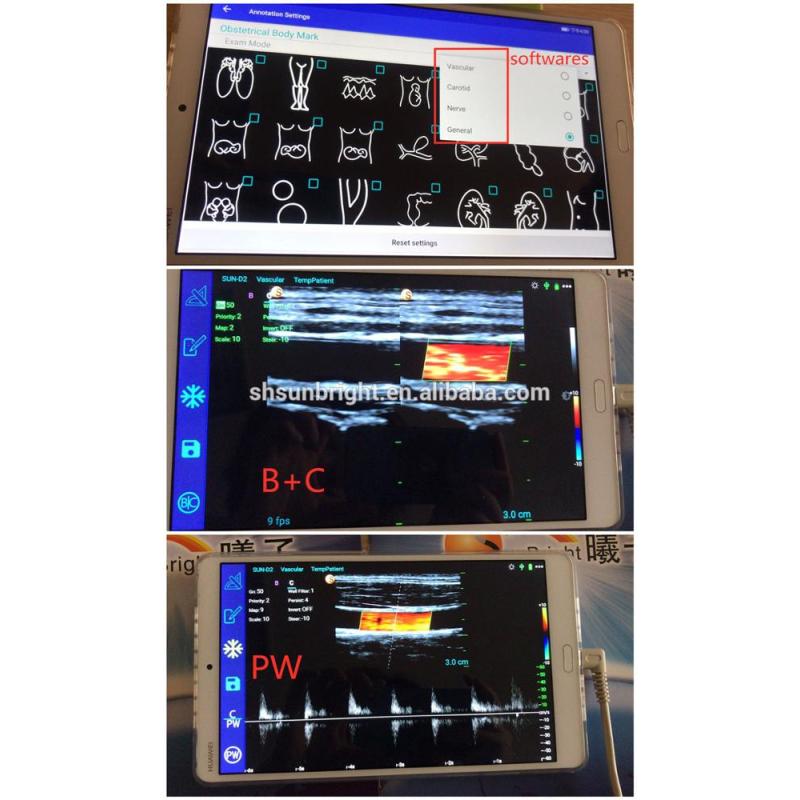 intensity focused ultrasound Sunbright double head USB Type C color Doppler convex & Linear probe