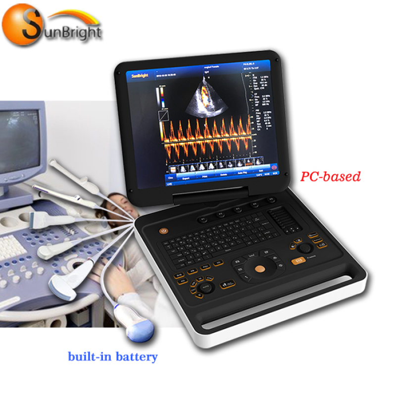 최고의 가격 휴대용 echograph 노트북 컬러 도플러 기계 스캐너 SUN-906A