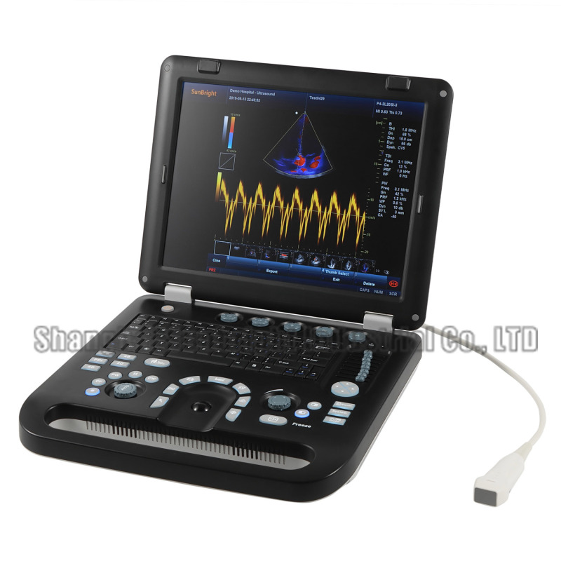 OB Urology Gynecology Digital Color Doppler Diagnostic ultrasonido 4d ecografo portatil ginecologico