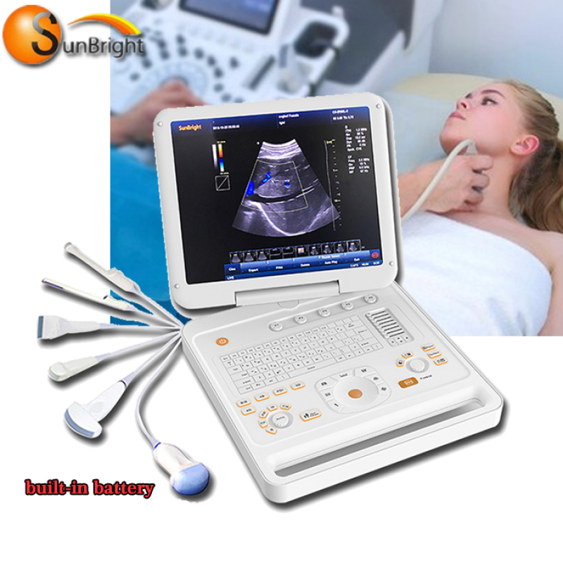 built in screen wireless ultrasound scanner 3D laptop PW color Doppler