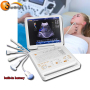 built in screen wireless ultrasound scanner 3D laptop PW color Doppler