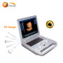 laptop 15 inches ultrasound diagnostic system machine 3d ultrasound machine cost