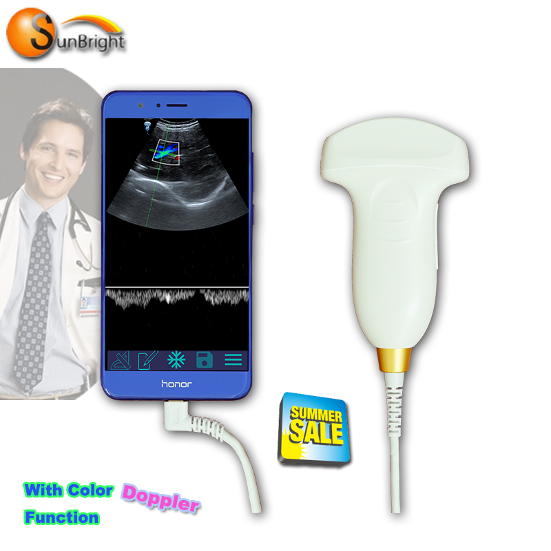 SUN-D1 долоні Ультразвуковий акушер-гінеколог кольоровий допплер Мобільний телефон Type-C USB конвексний датчик із сертифікатом CE