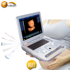 Wholesales price laptop 3D portable ultrasound scanner laptop ultrasound machine