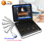 high intensity portable color doppler echocardio graphy ultrasound machine for humans