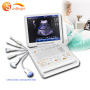 new upgraded high performance trolley portable ultrasound medical portable laptop usg machine