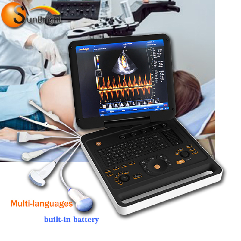 Hospital Cardiac Vascular PW 3D laptop color doppler Ultrasound medical equipment