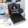 Hospital Cardiac Vascular PW 3D laptop color doppler Ultrasound medical equipment