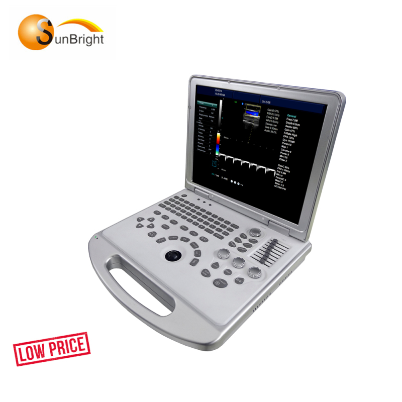 Factory direct wholesale portable lightweight color doppler ultrasound machine
