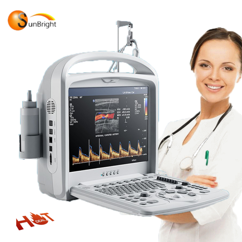 Portable Obstetrics and Gynecology Pregnancy PC-based Color Doppler Ultrasound Machine