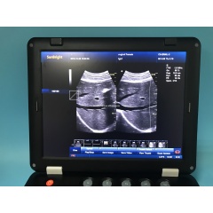 Unbelievable low price medical ultrasound machine 3d 4d color doppler usg with volume probe for pregnancy 906A