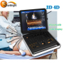 high end clinic color Doppler cardio ultrasound equipment