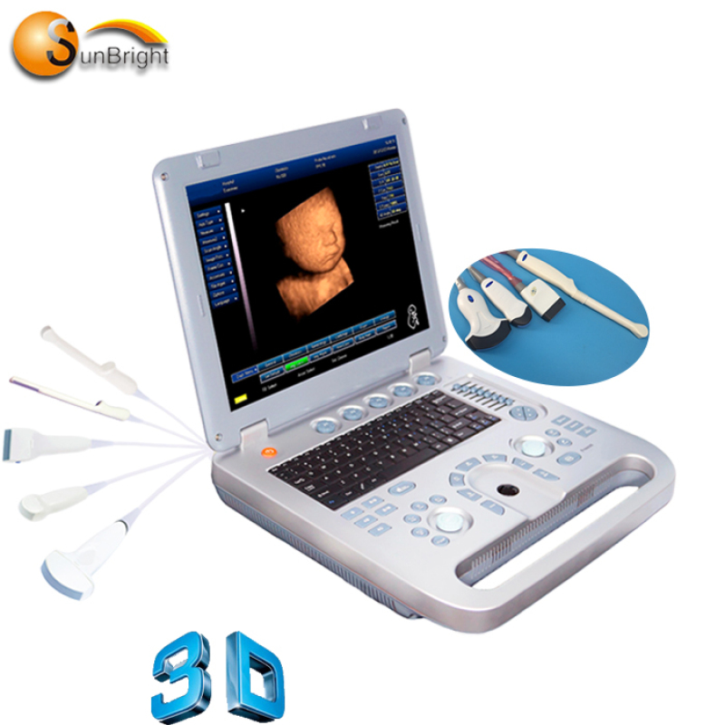 Système d'échographie portable à affichage LED de 15 pouces pour test vasculaire gynécologique d'urologie obstétricale