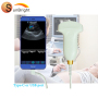 factory price well performance medical portable iphone connect usb ultrasound probe for sale