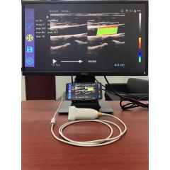 128 element color doppler wireless ultrasound Linear probe CW doppler USB Linear probe