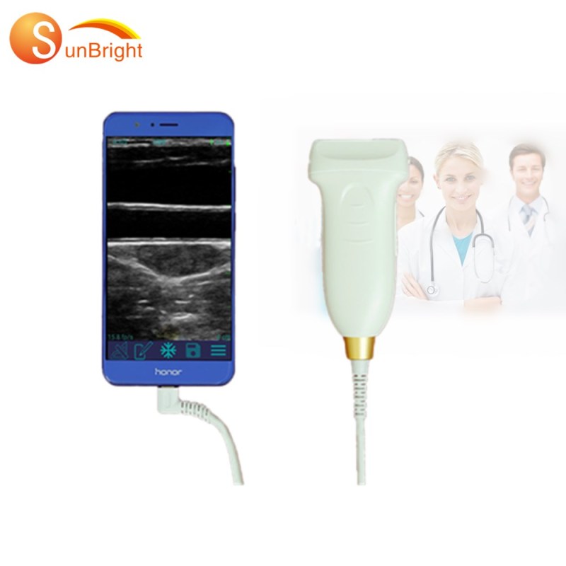 New Product USB&WiFi Ultrasound Linear Probe For Android/Windows Device cheapest ultrasound probe