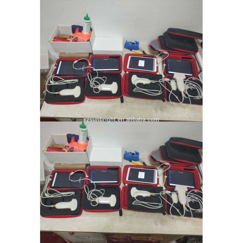 Hot Sale Portable Color Doppler usb android wireless ultrasound probe convex