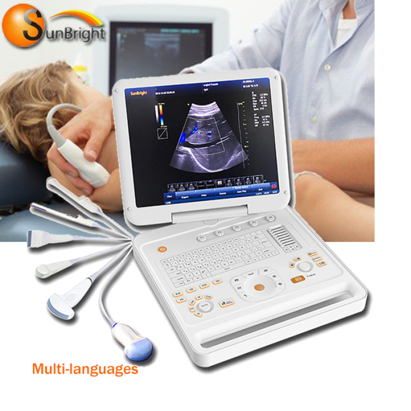 Portable Affordable diagnostic ultrasound color doppler Machine for Sale