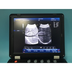 128 elements 3D medical THI ultrasound machine for sale with convex probe