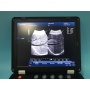 Win7 PC platform laptop doppler ultrasound 3d gynecologic / pregnancy  doppler ultrasound
