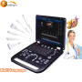 Portable Laptop 4D color Doppler ultrasound machine pregnancy system machine dactory price