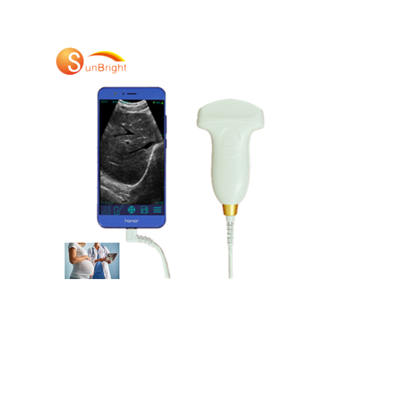 Hot sale Smart USB convex Wireless probe ultrasound potable medical scanner