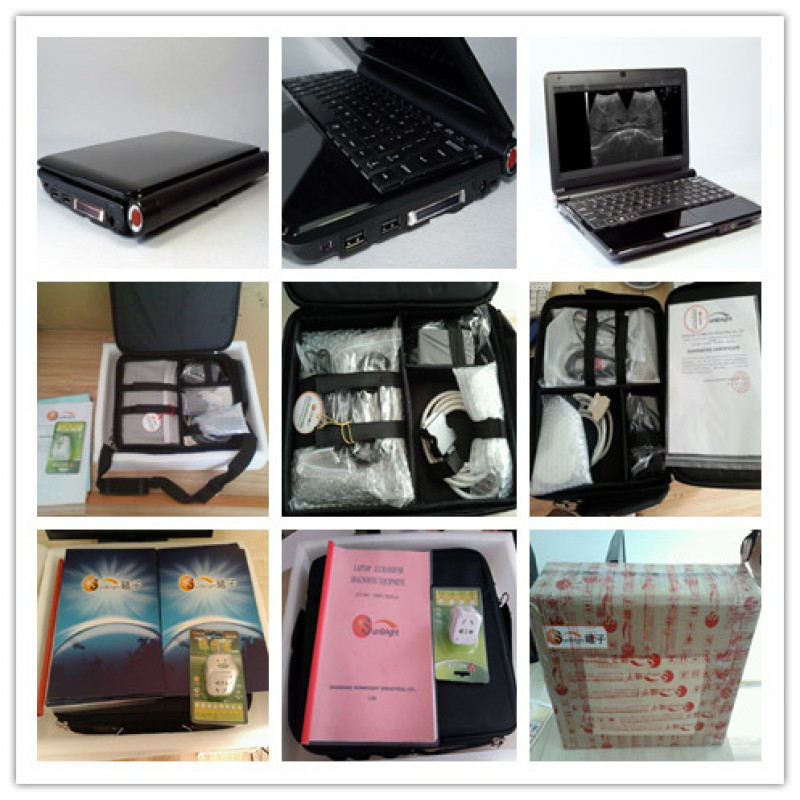 Mini macchina portatile portatile per scanner ad ultrasuoni ecografico ad ultrasuoni