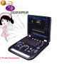 Can test many measurement color doppler ultrasound machine 3d 4d ultrasound