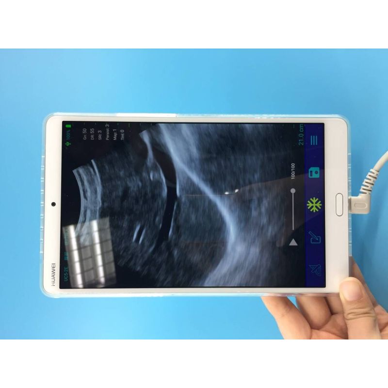 128 elements wireless color doppler convex usg ultrasound probe