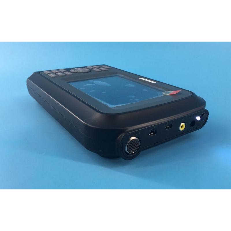 Cardiac 2D handheld ultrasound echocardiography ultrasound echo machine price