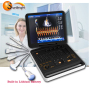 Hospital 3D/4D CW Color Doppler Ecografo Portable Portatil Ultrasound Machine For Pregnancy