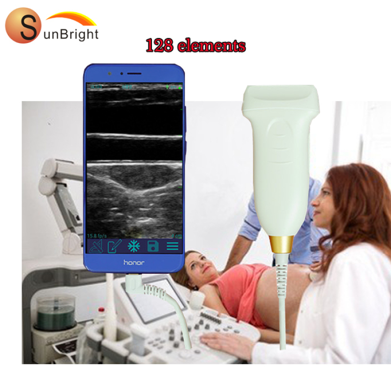 휴대용 초음파 변환기 의사 컬러 도플러 PW 선형 프로브 USB 초음파 스캐너 휴대용
