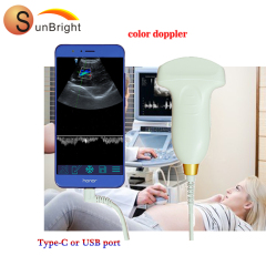 ultrasound linear probe price USB Probe Mini Ultrasound Machine Portable