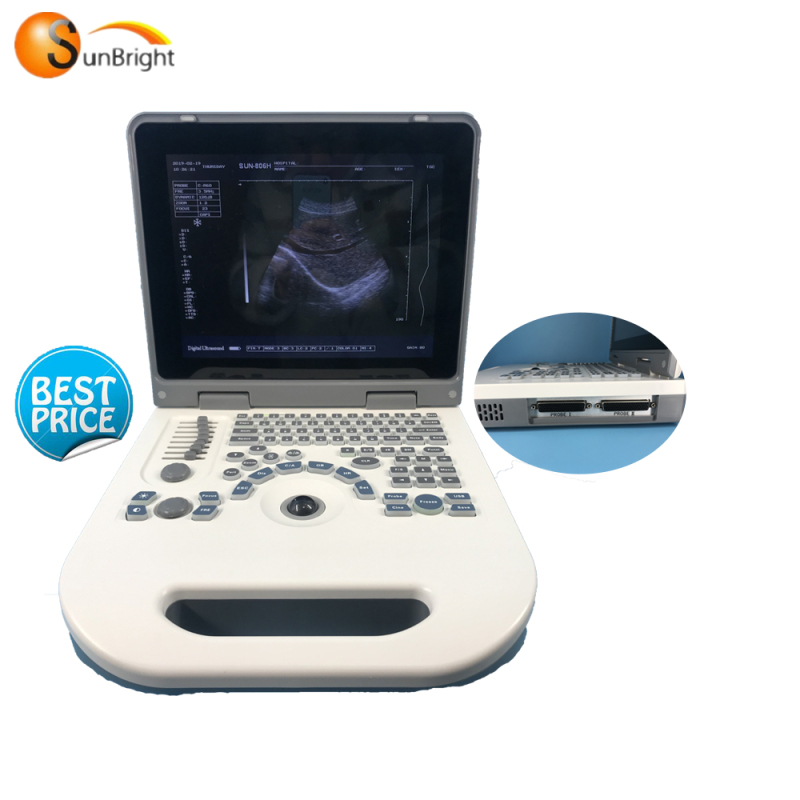 Macchina SUN-806G di scansione ad ultrasuoni per laptop con batteria a LED ad alte prestazioni