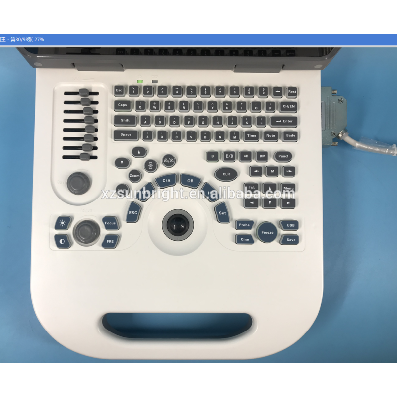 Notebook B/W Ultrasound Machine Sun-806G