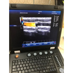 Widely used high quality fetal doppler machine color doppler ultrasound