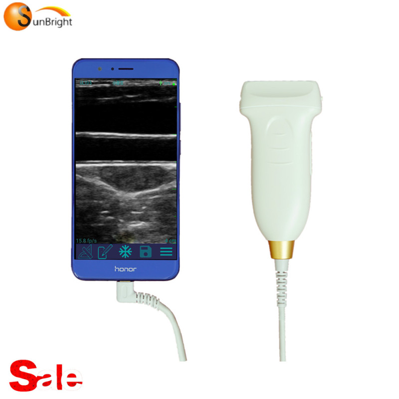 High quality SUN-P2 type USB ultrasound linear probe for smartphone