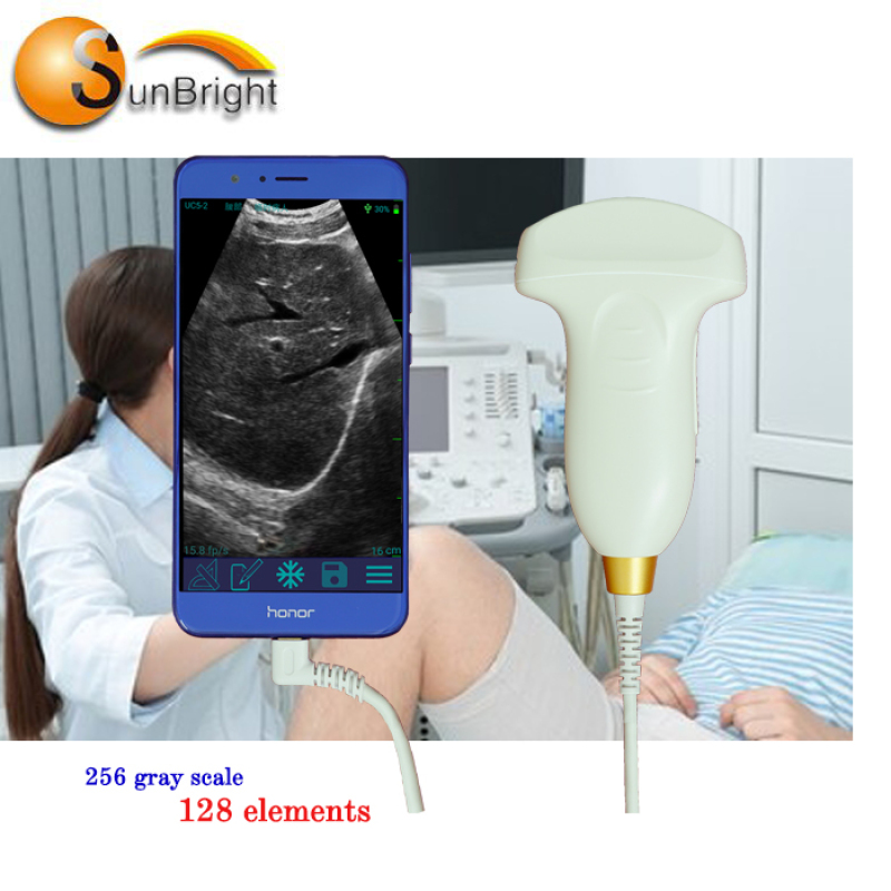high intnsity medical equipment handheld portable USB convex probe