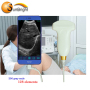 high intnsity medical equipment handheld portable USB convex probe