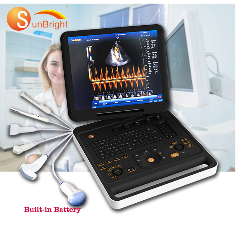 dispositivo palmare ad ultrasuoni doppler medico digitale ad alta risoluzione