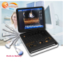 dispositivo palmare ad ultrasuoni doppler medico digitale ad alta risoluzione