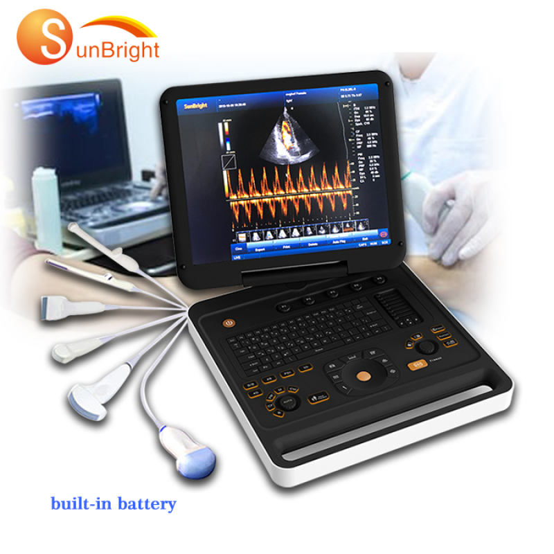 15-Zoll-Display heiße Farbe Doppler klares Bild SUN 906A ecografo color