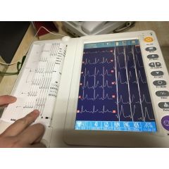 12 channel 6 channel color touch screen ecg machine 12 lead