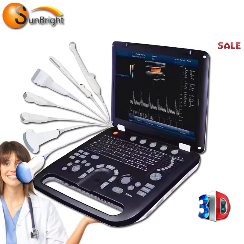 SUN-906A Nueva llegada urología vejiga China ultrasonido color Doppler escáner médico