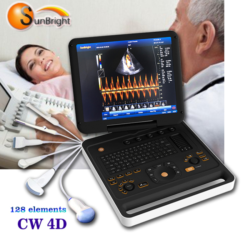 High image quality laptop 4D color Doppler handheld CW color Doppler ultrasound