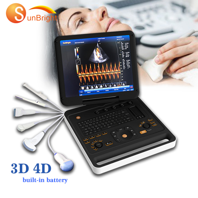 high end PW color Doppler ultrasound 3D medical scanner system