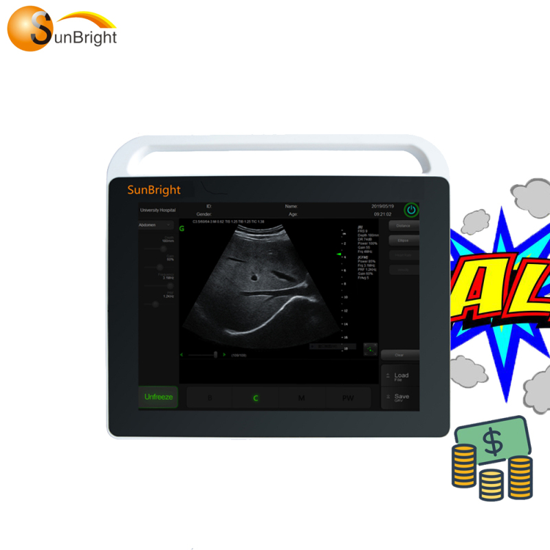 Удосконалений портативний ультразвуковий кардіоапарат із сенсорним екраном SUN-800S за найкращою ціною в Китаї